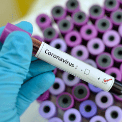 Coronavirus Interview