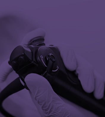 Image of hand holding an endoscope.
