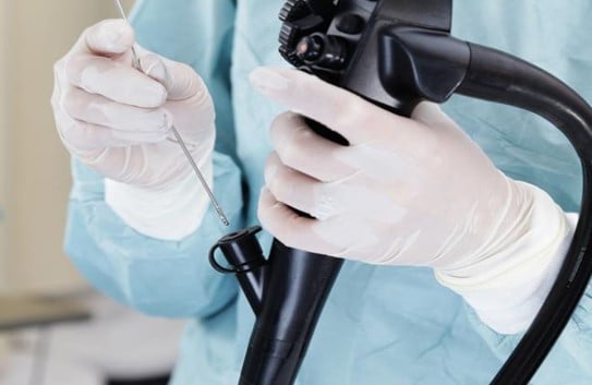 flexible gastrointestinal endoscope