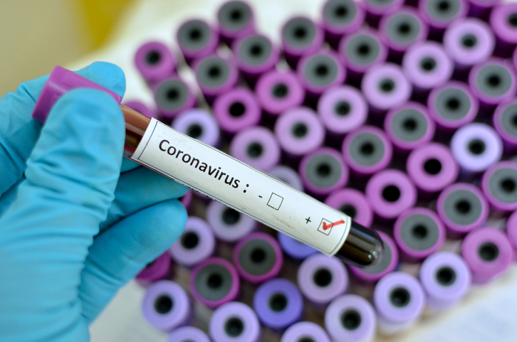 coronavirus sample held by a healthcare professional wearing protective gloves